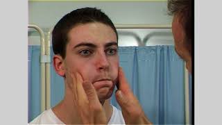 Facial nerve examination Cranial nerve 7 [upl. by Kenwrick657]