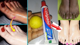 Foot Whitening Colgate Toothpaste At Home Remedies  Feet Whitening Pedicure At Home [upl. by Hsihsa]