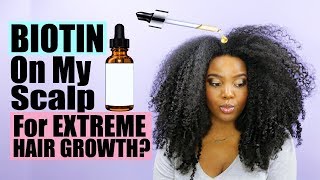 Putting Biotin On Your Scalp For EXTREME Hair Growth  Natural Hair [upl. by Lev]