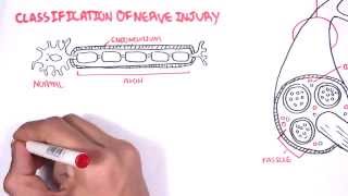 Neurology  Nerve Damage and Regeneration [upl. by Quitt719]