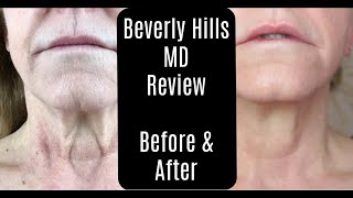 Beverly Hills MD Dermal Repair Complex—Lift and Firm Sculpting Cream—Before and After—AntiAging [upl. by Arvell]