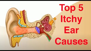 Top 5 Causes of Itchy Ears and Treatment Too [upl. by Rexanne]