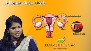 Fallopian Tube Block  Kannada  Siddha Permanently Cure  Ethnic Health Care [upl. by Tuchman]