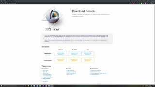 3D Slicer Tutorial 1 Basics [upl. by Gnilrad896]