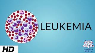 LEUKEMIA Causes Signs and Symptoms Diagnosis and Treatment [upl. by Nwadrebma]