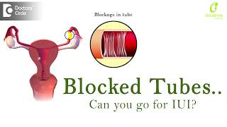 Is IUI Possible with blocked tubes  Fallopian Tube Blockage  Dr Uma Maheshwari of C9 Hospitals [upl. by Seedman]