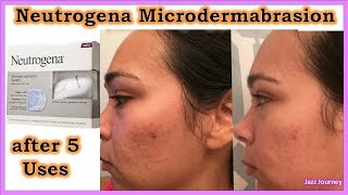 NEUTROGENA MICRODERMABRASION Review before amp after [upl. by Donough]