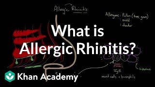 What is the treatment for allergic rhinitis [upl. by Ecyak776]