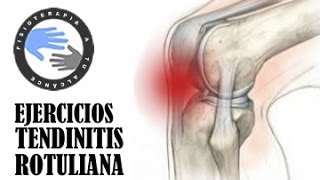 Tendinitis rotuliana ejercicios tratamiento y rehabilitacion [upl. by Ainad572]