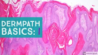 Basic Dermpath Cases  Explained by a Dermatopathologist [upl. by Meredeth]