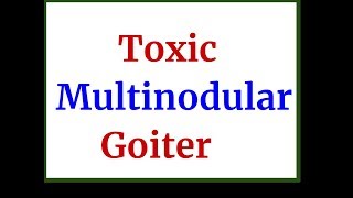 Toxic Multinodular Goiter [upl. by Iduj894]