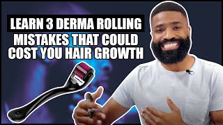 3 Derma Rolling MISTAKES that could cost you hair growth [upl. by Banyaz]