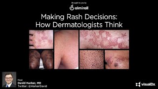 Making Rash Decisions How Dermatologists Think  Dr David Harker [upl. by Teddie34]