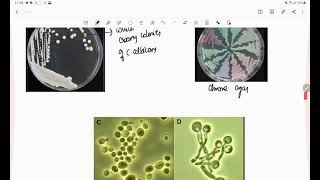 candidiasis  candida mycology microbiologylab diagnosis [upl. by Amles]