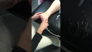 Dry Needling for Plantar Fasciitis [upl. by Rednasxela138]