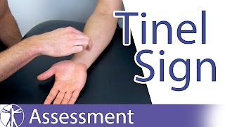 Tinel Sign Wrist  Carpal Tunnel Syndrome Diagnosis [upl. by Einahc310]