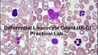 Differential Leucocyte Count DLC Practical Lab [upl. by Ydderf]