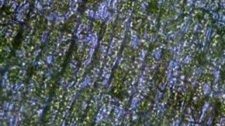 Plasmolysis in Elodea [upl. by Katey]