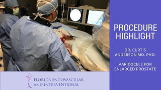 Florida Endovascular amp Interventional  Procedure Highlight 5 Varicocele Embolization [upl. by Youngran878]