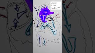 Tricuspid Atresia CHD Shorts [upl. by Jerrilee889]