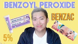 Benzac Benzoyl Peroxide 5 Review for Acne Philippines [upl. by Karilla]