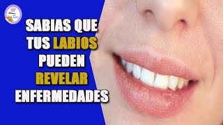 Tus labios pueden revelar enfermedades [upl. by Hanus]