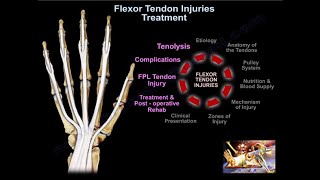 Flexor Tendon Injuries Treatment  Everything You Need To Know  Dr Nabil Ebraheim [upl. by Nhor]