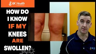 How do I know if my knees are swollen [upl. by Enytsirhc926]