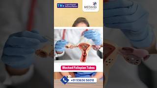 Fallopian Tube Recanalization Explained in Tamil [upl. by Pascasia473]