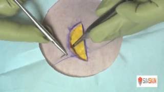 How to Close a Wound with Surgical Staples [upl. by Aifos]