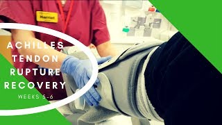 Achilles Tendon Rupture  Week 5 6  My Recovery Tips Advice [upl. by Armahs]