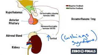 Understanding The Dexamethasone Suppression Test [upl. by Griggs]