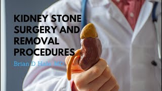 Kidney Stone Surgery amp Removal Procedures  Dr Brian D Hale [upl. by Desimone]