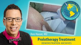 Dextrose Prolotherapy treatment for knee pain [upl. by Illa]