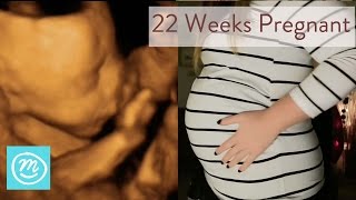 22 Weeks Pregnant What You Need To Know  Channel Mum [upl. by Hallagan451]