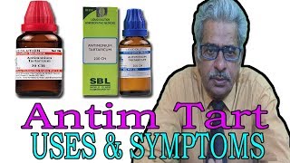 Anitim Tart  Uses amp Symptoms in Homeopathy by Dr PS Tiwari [upl. by Aiuhsoj11]