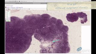 Histology Helper  Lymphoid Tissue Histology [upl. by Sigrid385]