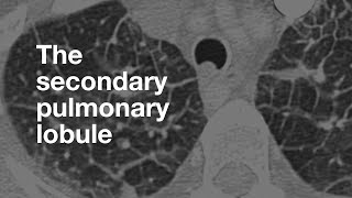 The Secondary Pulmonary Lobule [upl. by Adnarym856]