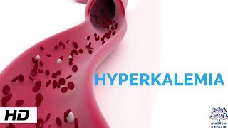 HYPERKALEMIA Causes Signs and Symptoms Diagnosis and Treatment [upl. by Nyletak]