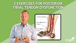 3 Exercises for Posterior Tibial Tendon Dysfunction [upl. by Anih293]