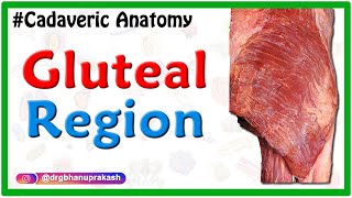 Gluteal region  Cadaveric Anatomy [upl. by Emmuela]