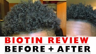 BIOTIN Hair Growth Results Before and After [upl. by Dranik806]