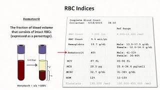 How to Interpret RBC Indices eg hemoglobin vs hematocrit MCV RDW [upl. by Gabbie]