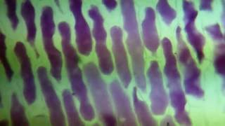 Red Onion Osmosis Plasmolysis begins at 110  Mr Pauller [upl. by Kreindler]