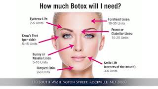 Basics of Botox Injection [upl. by Acinna]