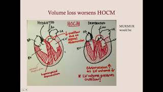 Cardiomyopathies  CRASH Medical Review Series [upl. by Curr]