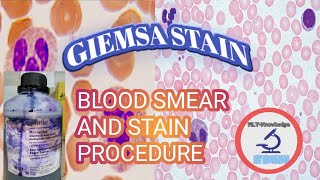 BLOOD SMEAR amp GIEMSA STAIN PROCEDURE [upl. by Lenka155]