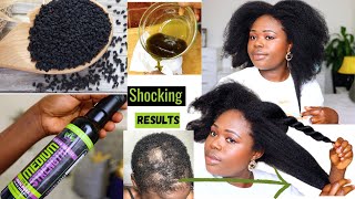 4 Ways to Use Pure Black Seed Oil For Massive hair Growth and For over all Health [upl. by Sello]