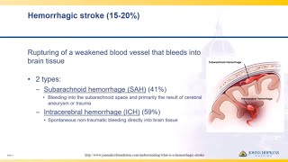 Stroke  Nucleus Health [upl. by Tamma]