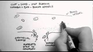 Haemostasis 1  Clots Thrombi amp Antiplatelets [upl. by Oza]